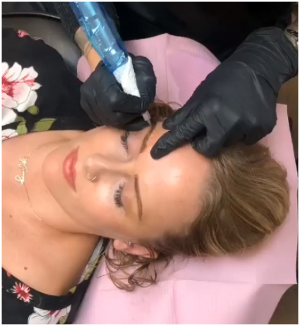 brow enhancement
