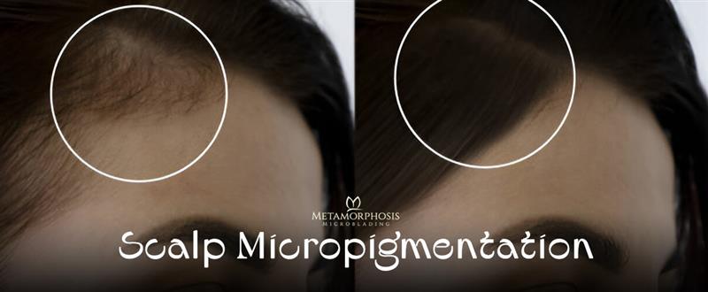 scalp images
