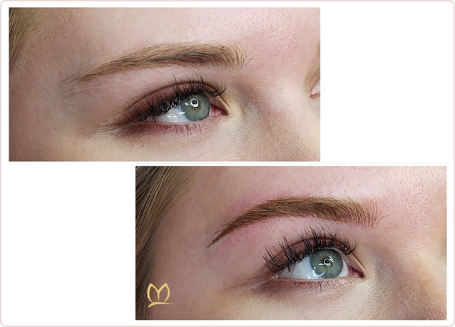 brow enhancement